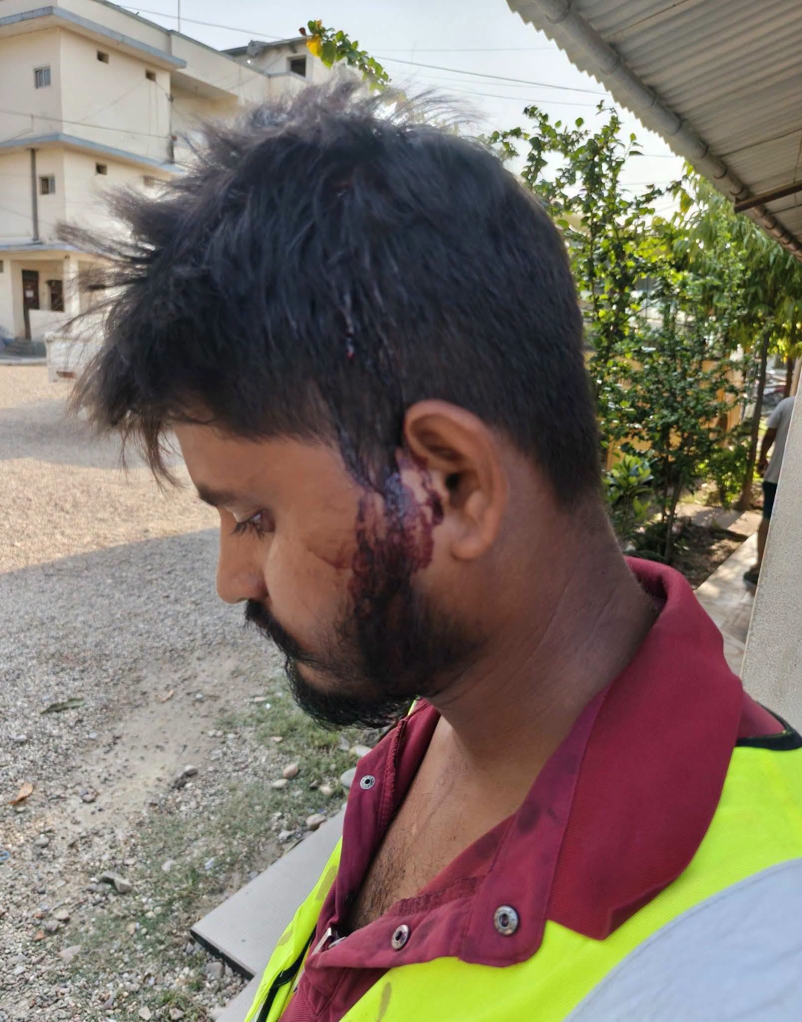 Reporter attacked while covering news in Dhanusha